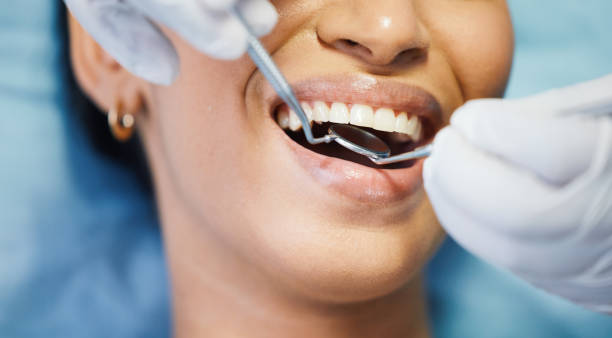 Best Urgent Care for Lost Fillings or Crowns in Port Jervis, NY