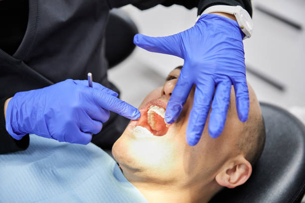 Best Emergency Dental Care for Broken or Chipped Teeth in Port Jervis, NY